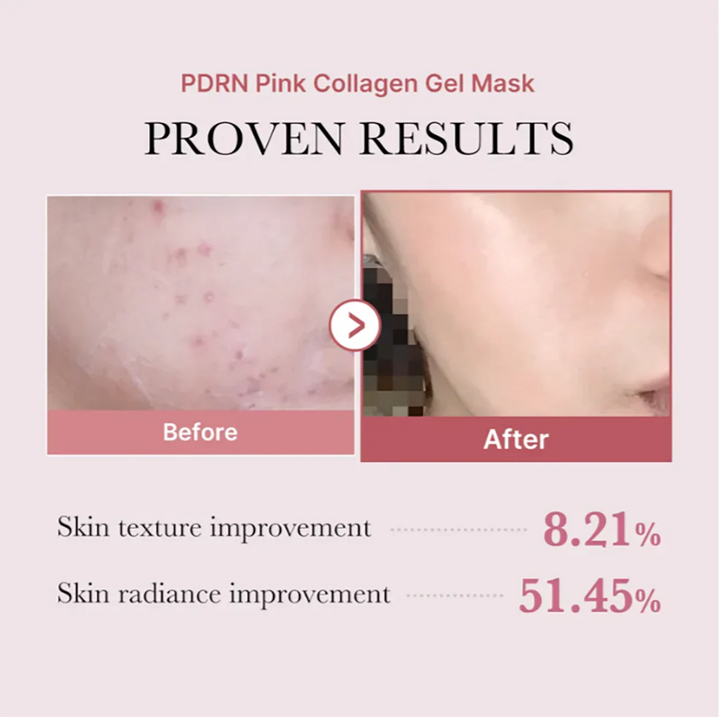 Medicube PDRN Pink Collagen Gel Mask (1 Sheet)