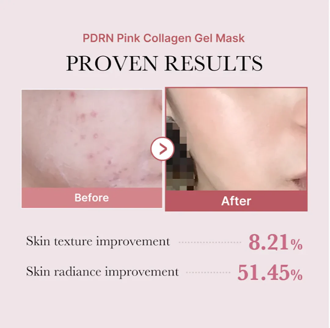 Medicube PDRN Pink Collagen Gel Mask (1 Sheet)